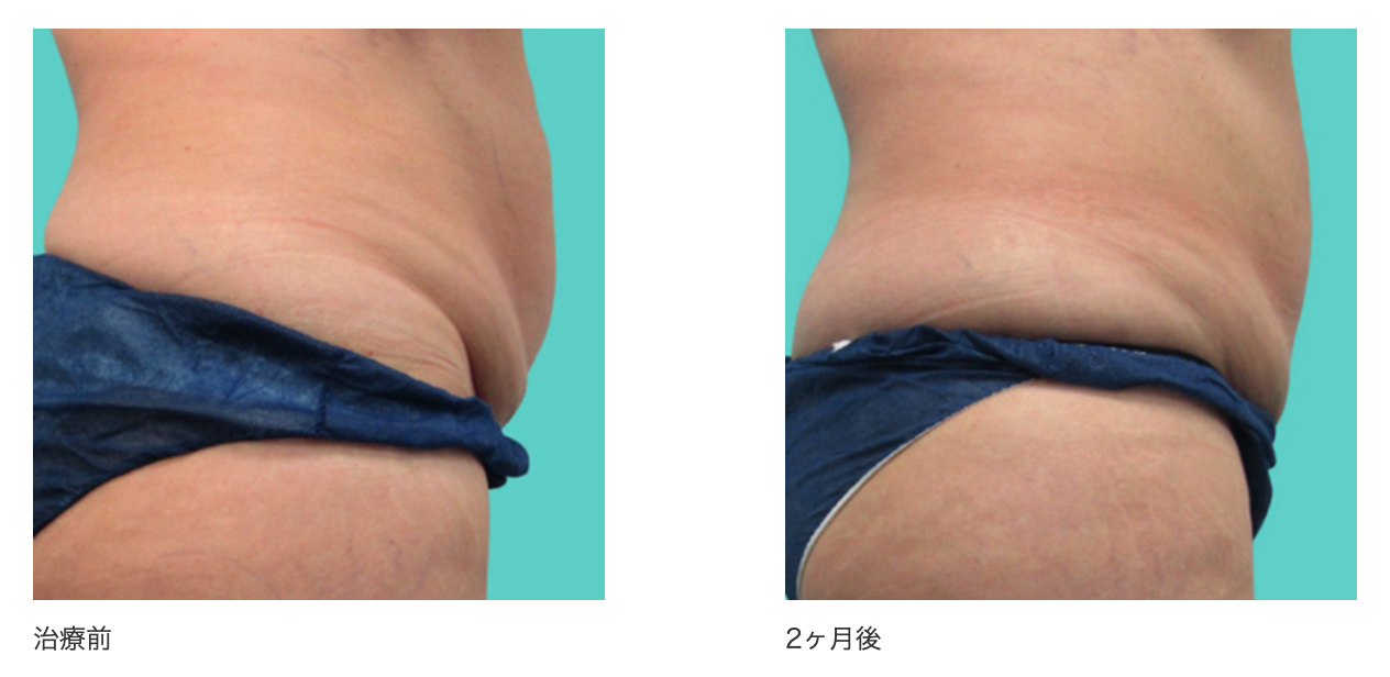 銀座よしえクリニック　クルスカ