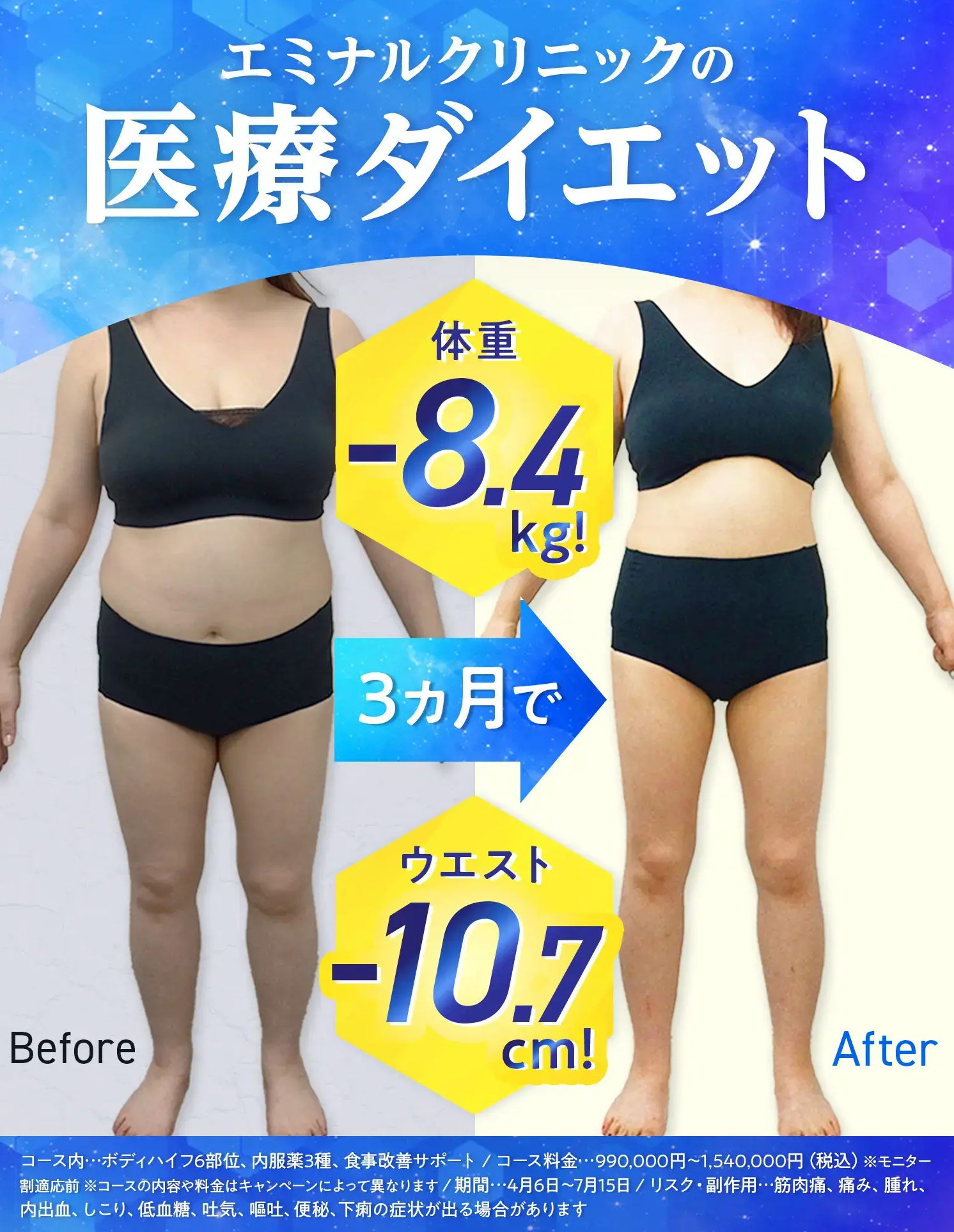 エミナルクリニックの医療ダイエット