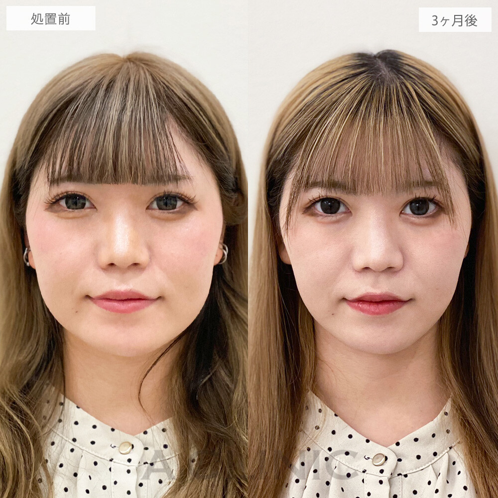 ACLINICの症例