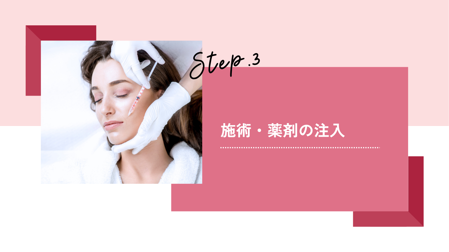 施術・薬剤の注入