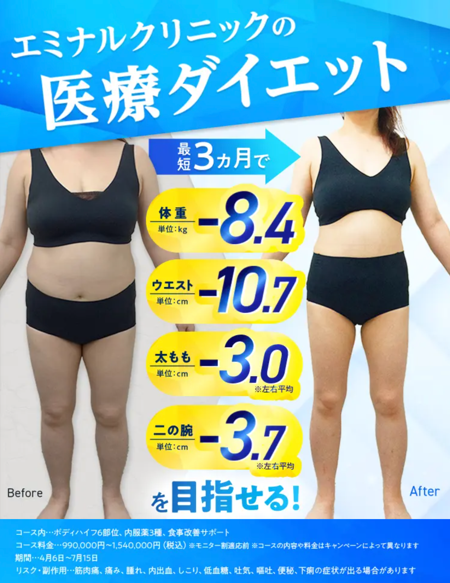 エミナルクリニックの医療ダイエットLP