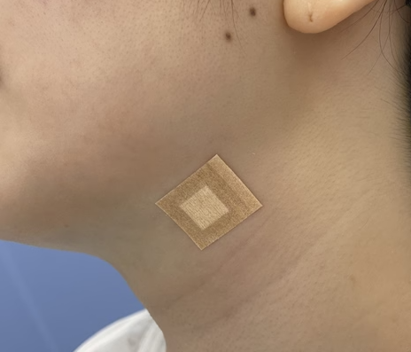 脂肪吸引注射は直接脂肪を取り除くので確実に脂肪を減らせる！