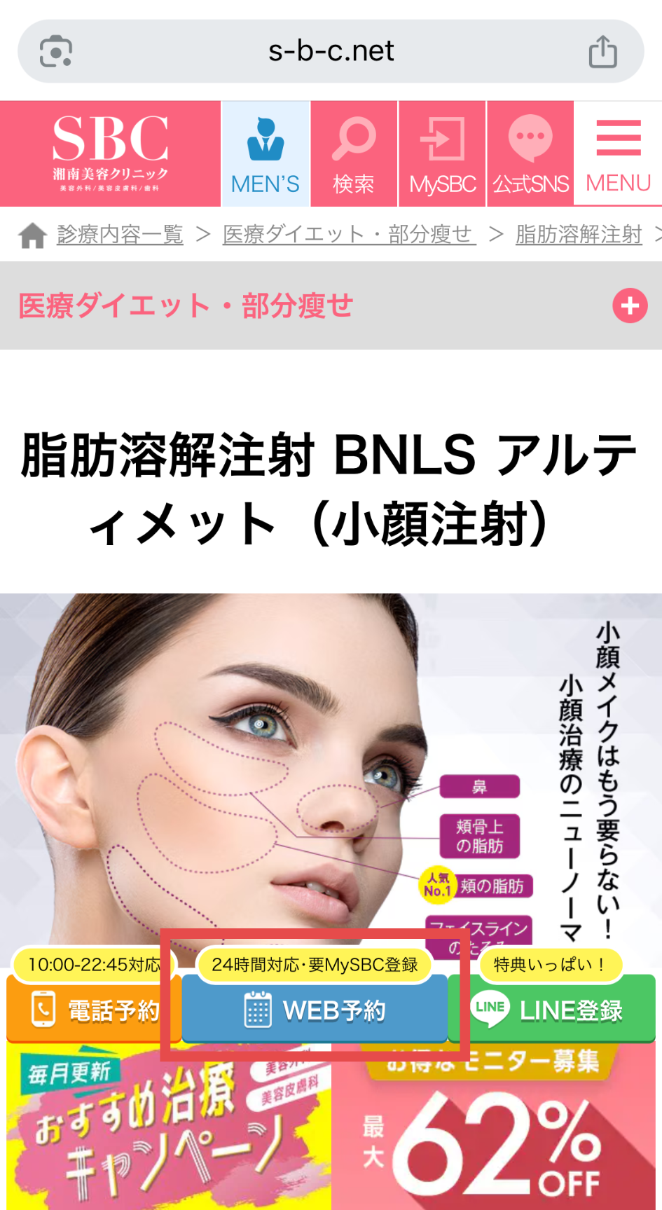 湘南美容クリニックの予約方法