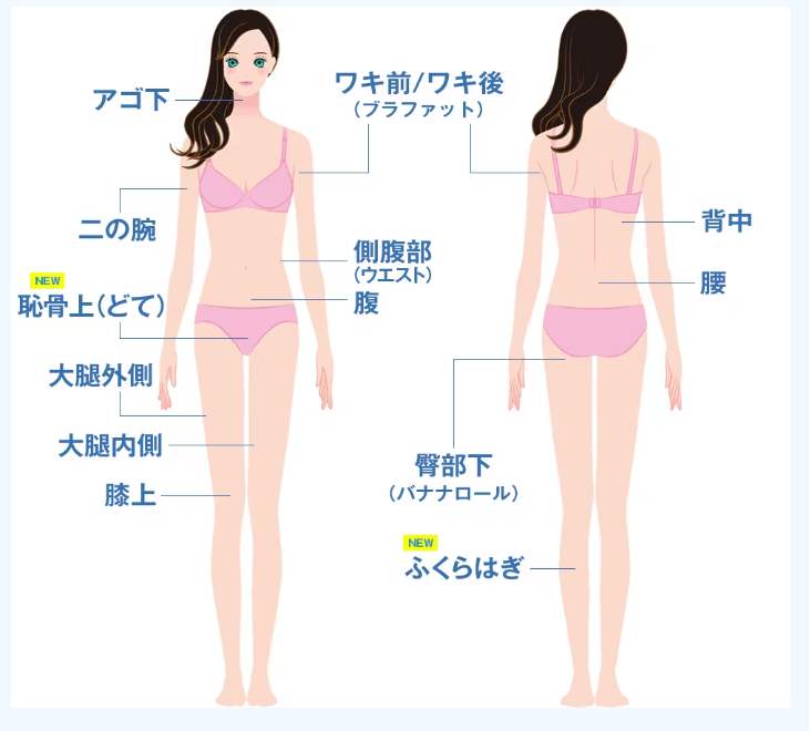クールスカルプティングダブル（クルスカダブル）は気になる部位にピンポイント施術可能！