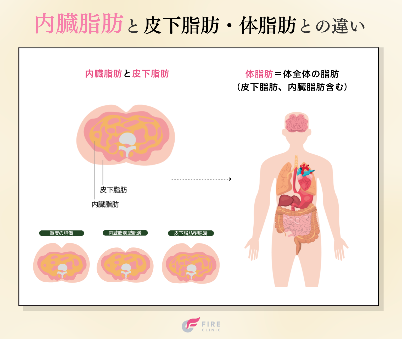 内臓脂肪とは？皮下脂肪や体脂肪との違い