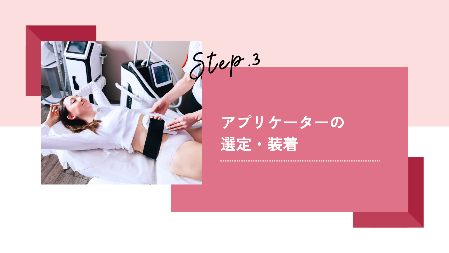 アプリケーターの選定・装着