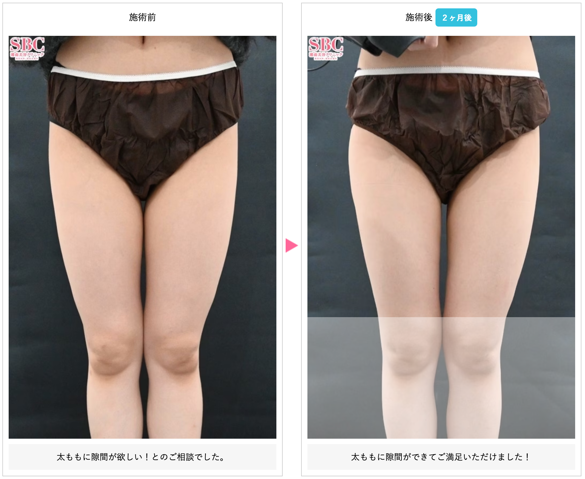 クルスカダブル症例