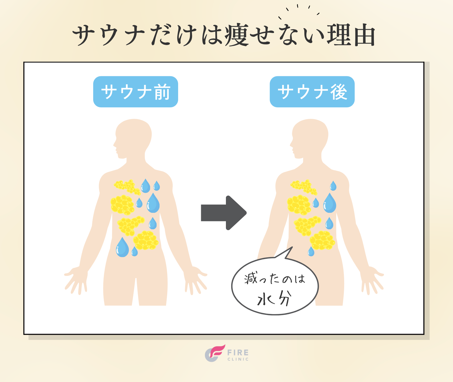 結論：サウナだけでは痩せない