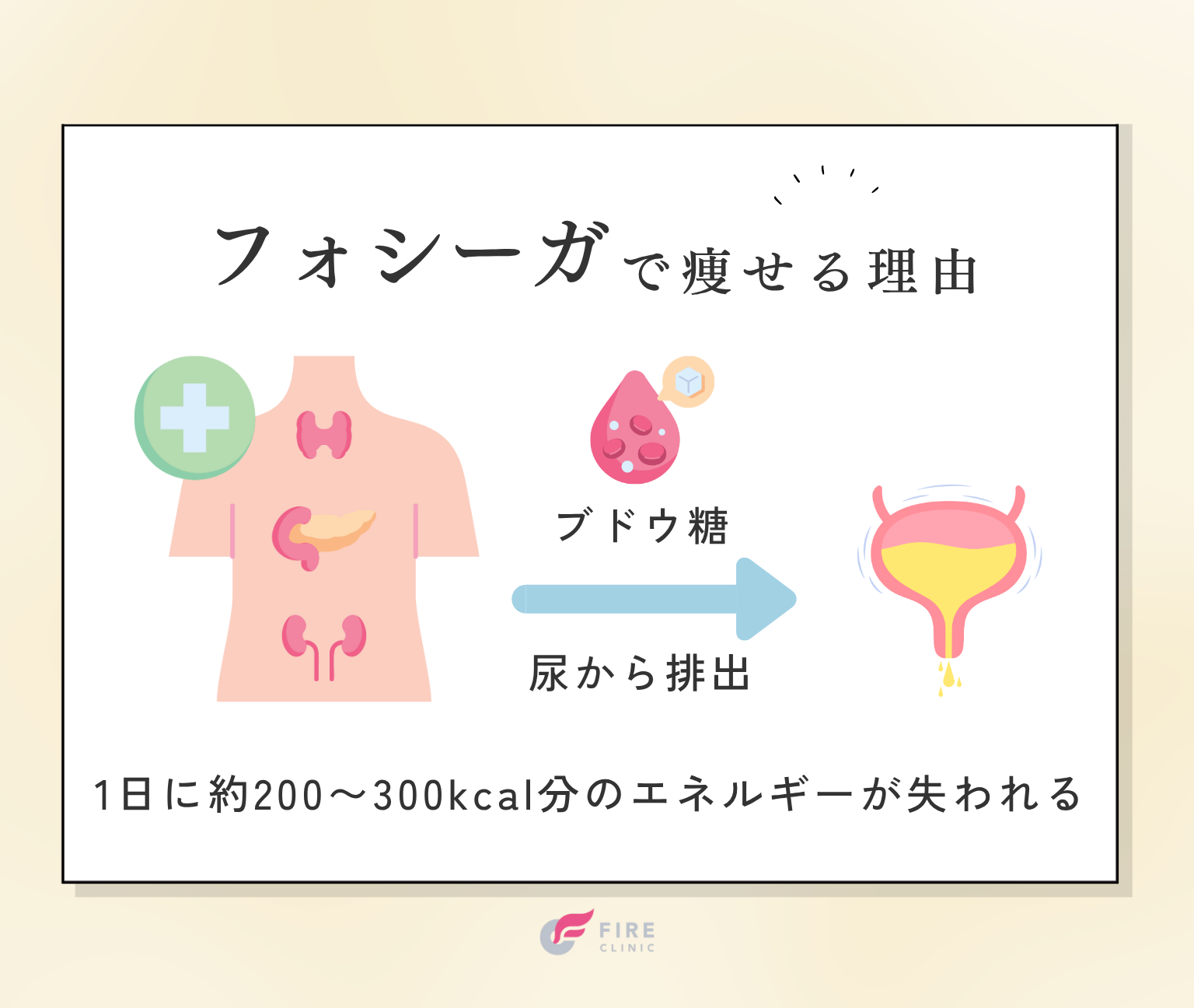 フォシーガで痩せる理由