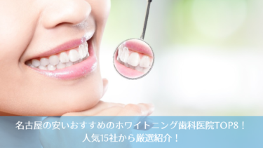 名古屋の安いおすすめのホワイトニング歯科医院TOP8！人気15社から厳選紹介！