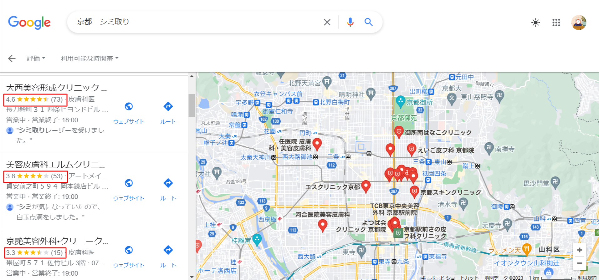 京都-シミ取り-Google-検索