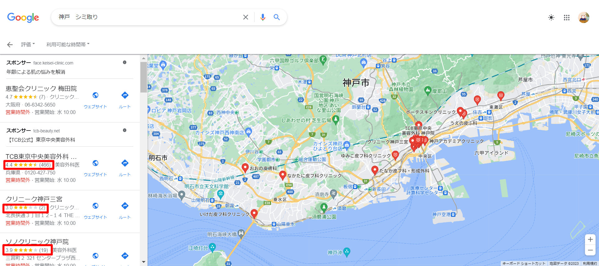 神戸-シミ取り-Google-検索