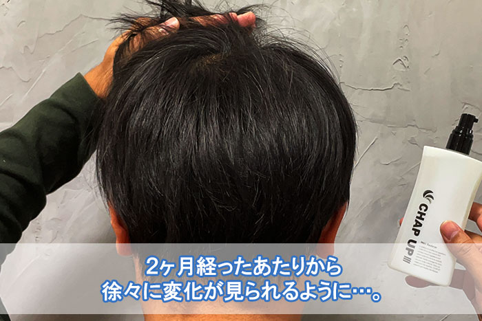 クマパック チャップアップ 育毛 ローションの通販 by KOKORO.Store