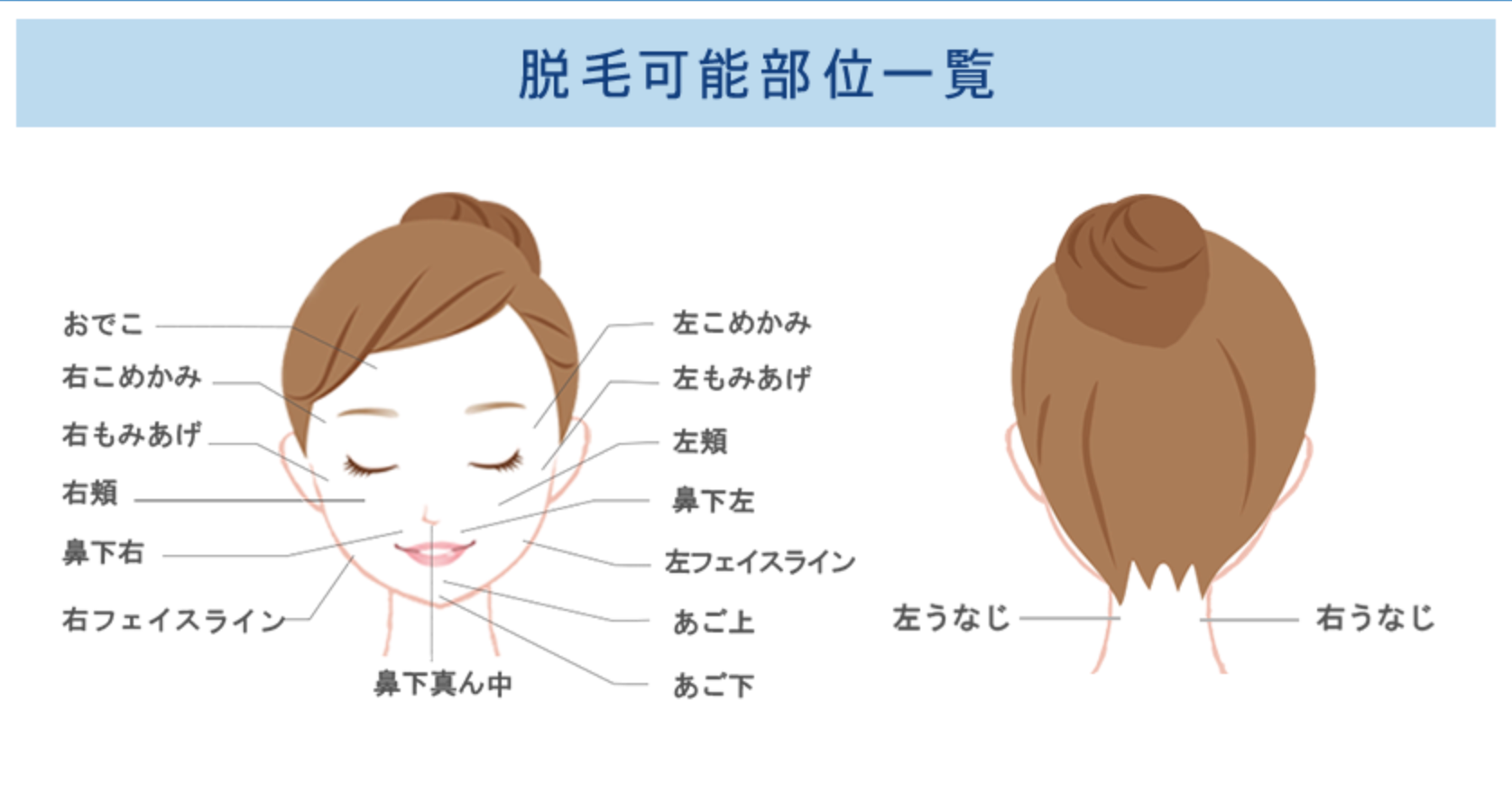 ストラッシュ　顔脱毛範囲