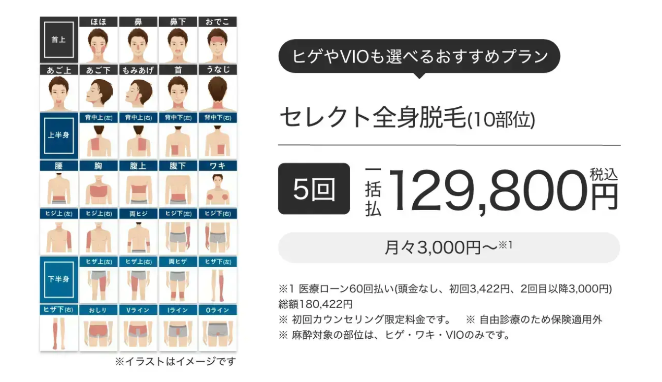 メンズエミナルセレクト全身脱毛
