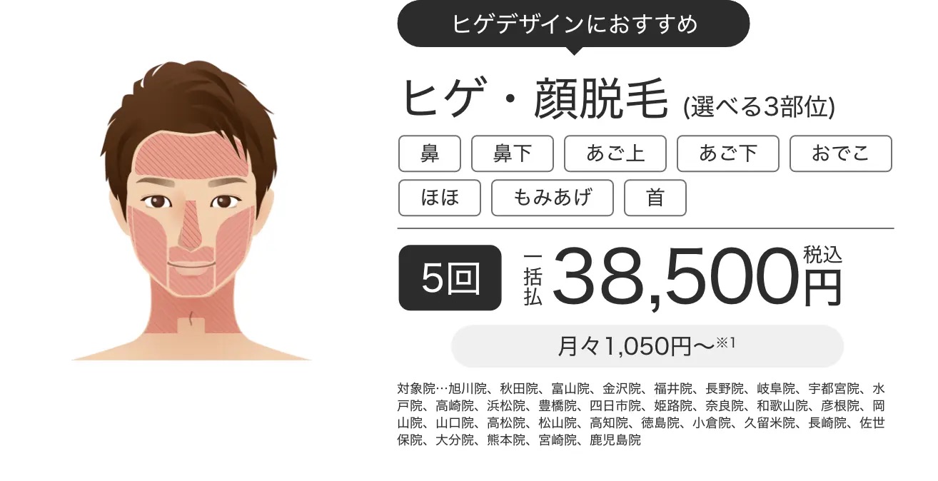 メンズエミナルのヒゲ脱毛3部位5回プラン