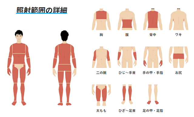 全身脱毛の部位