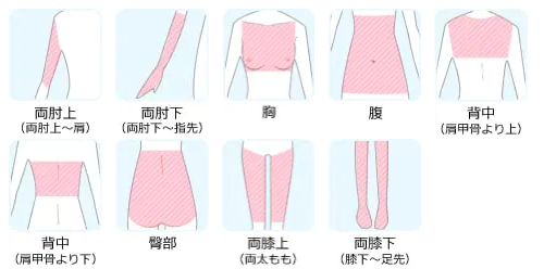 湘南美容クリニックLパーツ