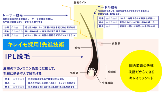 IPL脱毛