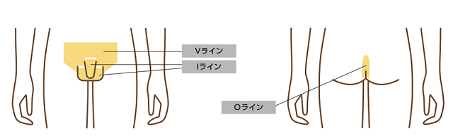 VIO脱毛の部位