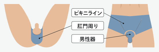 VIO脱毛の部位