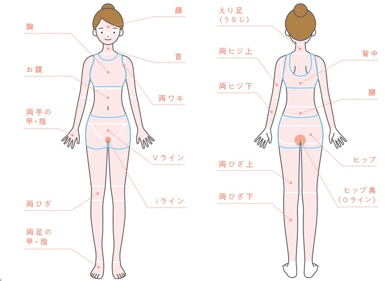 じぶんクリニックの全身脱毛範囲