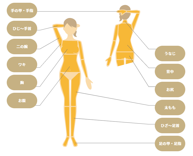 リゼクリニックの全身脱毛範囲