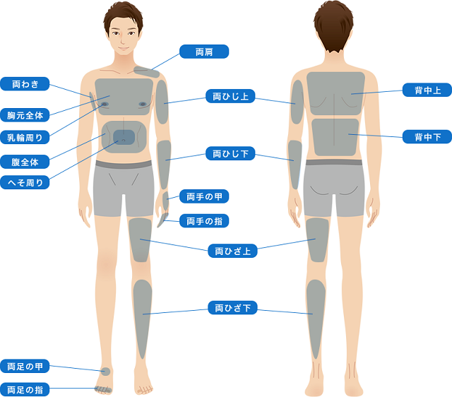 ボディ脱毛の部位