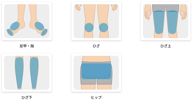 下半身脱毛の部位