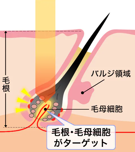 毛根にアプローチ