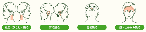 オプションコースの脱毛