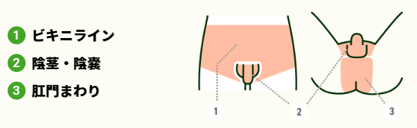 デリケートゾーン脱毛の部位