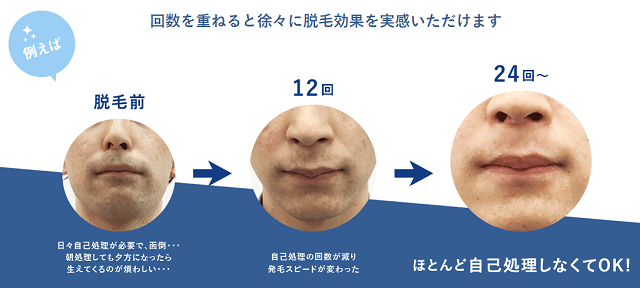 回数を重ねる度に効果を実感