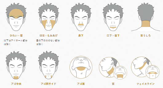 ヒゲ脱毛の箇所