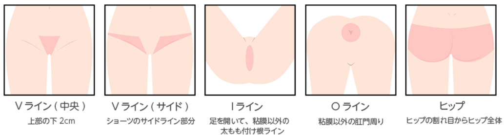 池袋レーザークリニック施術部位2