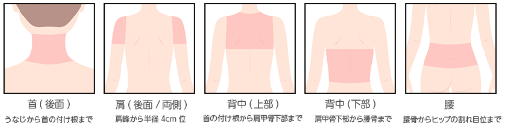 池袋レーザークリニック施術部位3