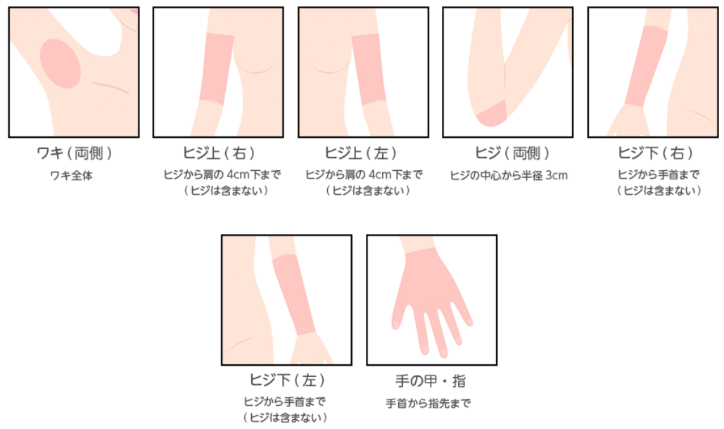 池袋レーザークリニック施術部位1