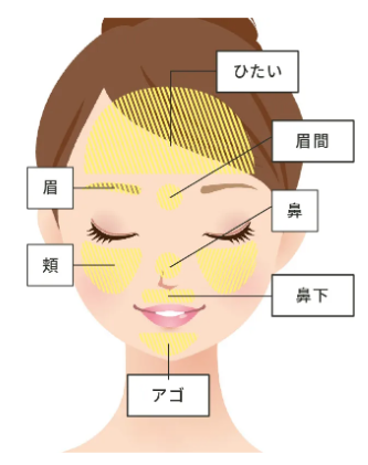 カレイドクリニック顔脱毛