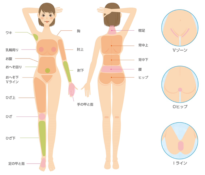 エムビューティークリニック全身脱毛イメージ