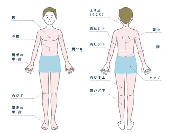 メンズじぶんクリニック全身脱毛