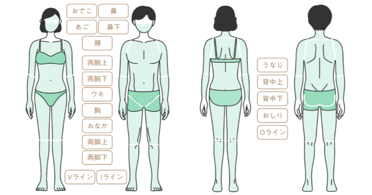 スキミークリニックの施術部位