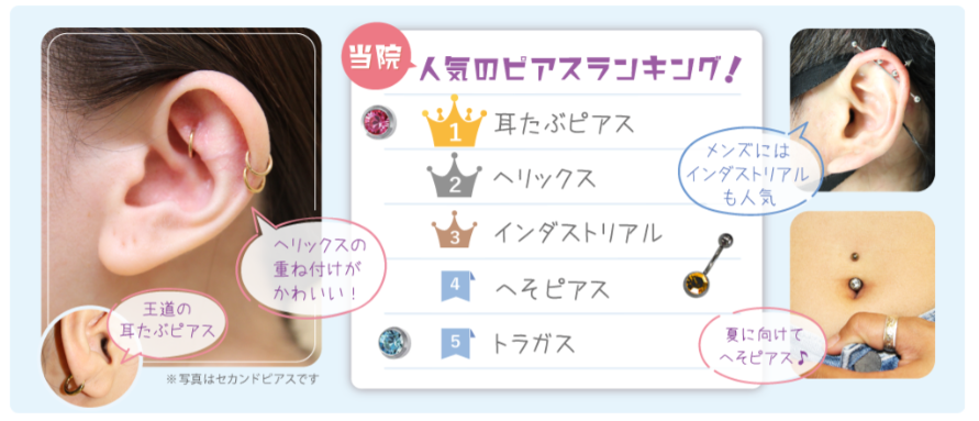 ヒルズ美容クリニックのピアスの穴開け