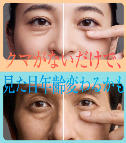 湘南美容クリニックのクマ取り