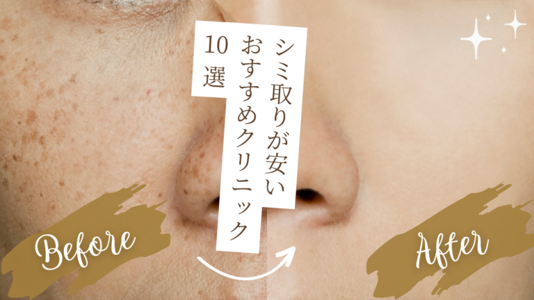 シミ取りが安いおすすめのクリニック10選