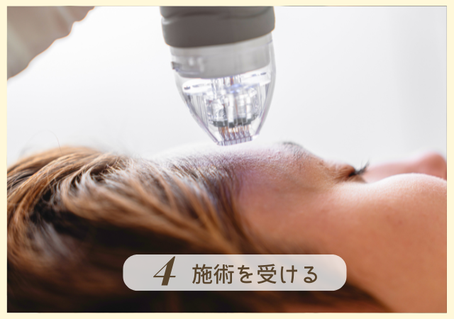 Step4.施術を受ける