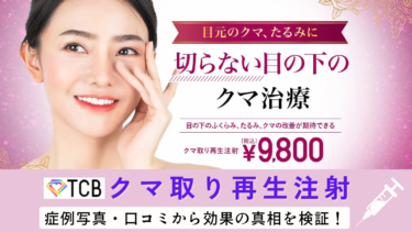 【口コミは？】TCBのクマ取り再生注射の効果の真相とデメリットについても解説！
