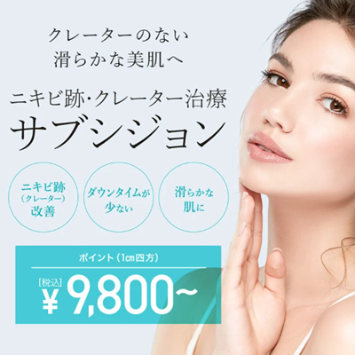 TCBのサブシジョン