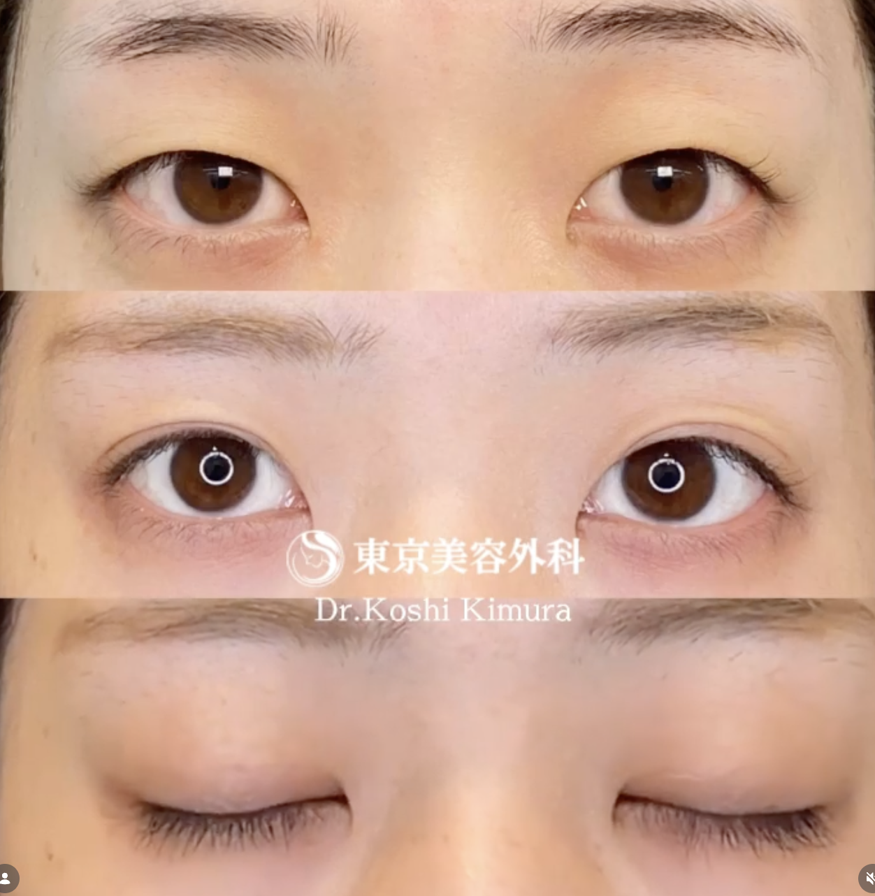 東京美容外科梅田　症例