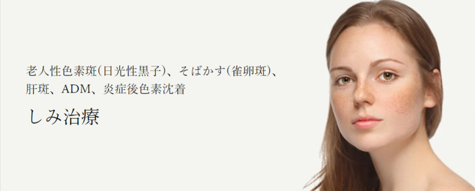 共立美容外科のシミ取り