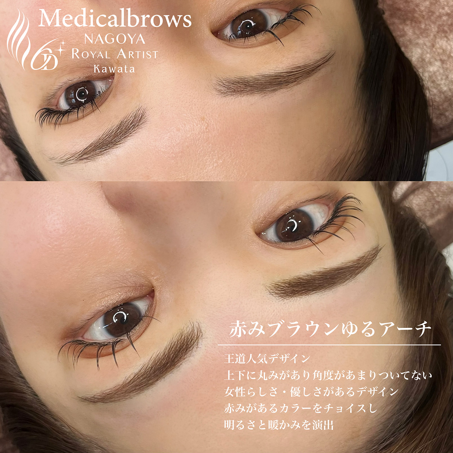 メディカルブロー河田さん症例写真